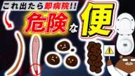 色・臭い・形..絶対に見逃してはいけない「うんち」からのSOS。知らないと後悔する超意外なサインとは？医師が徹底解説！