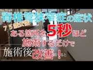 75歳女性 脊柱管狭窄症の症状 ある箇所を5秒ほど施術するだけで改善!