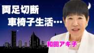 和田アキ子が歩行困難となり生涯"車椅子生活"となった姿に涙が零れ落ちた...手術失敗で顔面崩壊となった大御所タレント...子供がいない理由に驚きを隠せない...