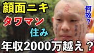 BreakingDownから姿を消した男が年収2000万越え?!顔面ニキは何で稼げてる?朝倉未来とコラボも…
