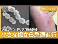 “人食いバクテリア”過去最多 致死率3割…「死を覚悟」片足失った男性 感染経路は【もっと知りたい!】【グッド!モーニング】(2024年1月22日)