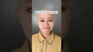なんでハゲてるんですか? #脱毛症