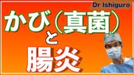 潰瘍性大腸炎、クローン病はカビが原因だった!