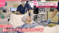 【マスク氏が開発に注力】脳にチップ“考えるだけでPC操作” 体動かなくても…初の被験者「大きな希望」