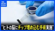 ヒト対象の脳インプラントを初実施…イーロン・マスク氏設立の「ニューラリンク」|TBS NEWS DIG