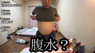 【公開】腹水の現状を公開する【金バエ】