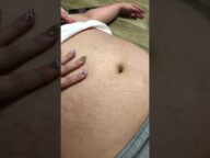デブの肉割れ腹肉事情 大橋ミチ子112kg