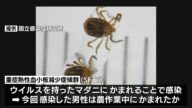 死亡の恐れも マダニ媒介の感染症患者を確認(静岡県)