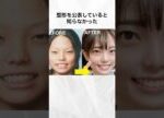 整形を公表していると知らなかった女性芸能人まとめ#shorts #芸能人 #整形