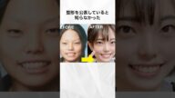 整形を公表していると知らなかった女性芸能人まとめ#shorts #芸能人 #整形