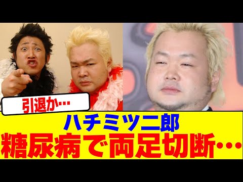 ハチミツ二郎が糖尿病で両足切断…【2chまとめ】【2chスレ】【5chスレ】